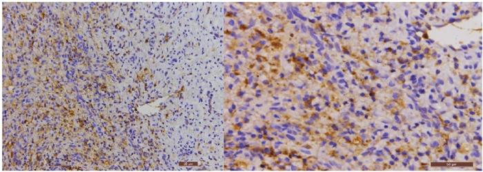 https://cdn.ncbi.nlm.nih.gov/pmc/blobs/c813/5589670/8cb0dd23f98a/oncotarget-08-55435-g002.jpg