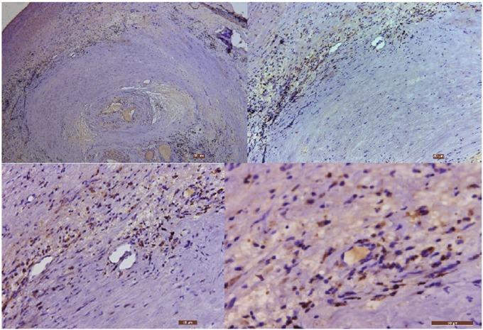 https://cdn.ncbi.nlm.nih.gov/pmc/blobs/c813/5589670/a87616bedab7/oncotarget-08-55435-g001.jpg