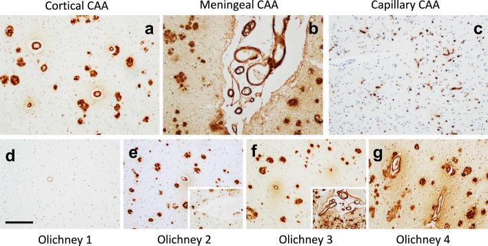 https://cdn.ncbi.nlm.nih.gov/pmc/blobs/c815/10870546/0bb11b8b5b2b/40478_2023_1714_Fig1_HTML.jpg