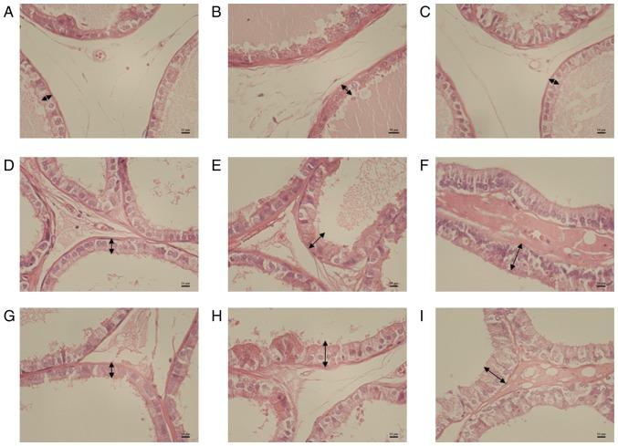 https://cdn.ncbi.nlm.nih.gov/pmc/blobs/c819/7086227/291abee4033d/etm-19-04-2551-g00.jpg