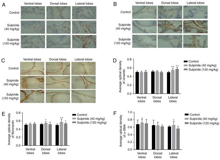 https://cdn.ncbi.nlm.nih.gov/pmc/blobs/c819/7086227/2a68dffd06cc/etm-19-04-2551-g05.jpg
