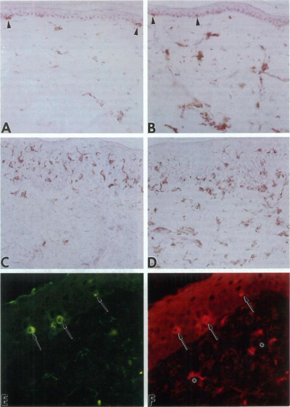 https://cdn.ncbi.nlm.nih.gov/pmc/blobs/c823/1858058/7aaa6c77d2a5/amjpathol00022-0046-a.jpg