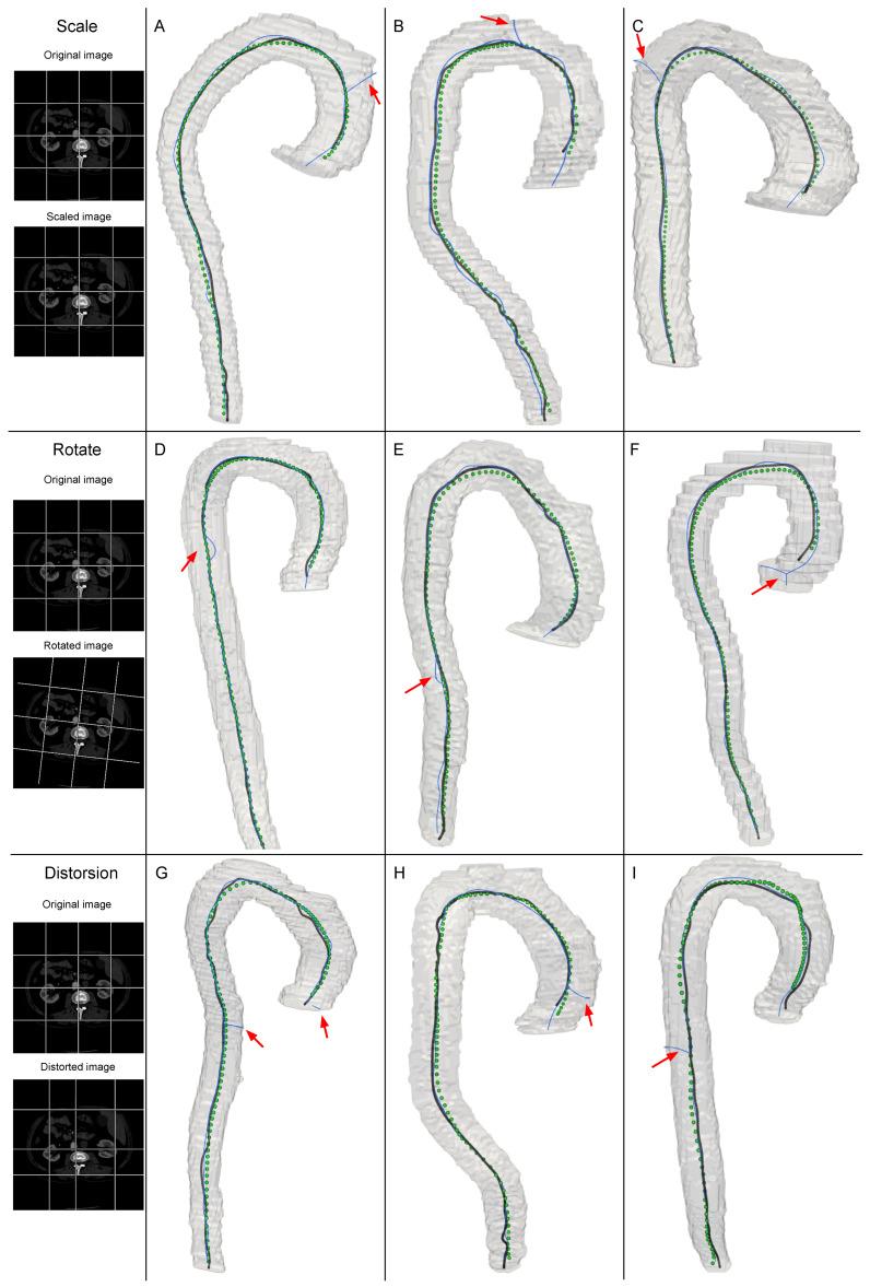 https://cdn.ncbi.nlm.nih.gov/pmc/blobs/c825/12295992/0215151fd0e4/jimaging-11-00209-g003.jpg