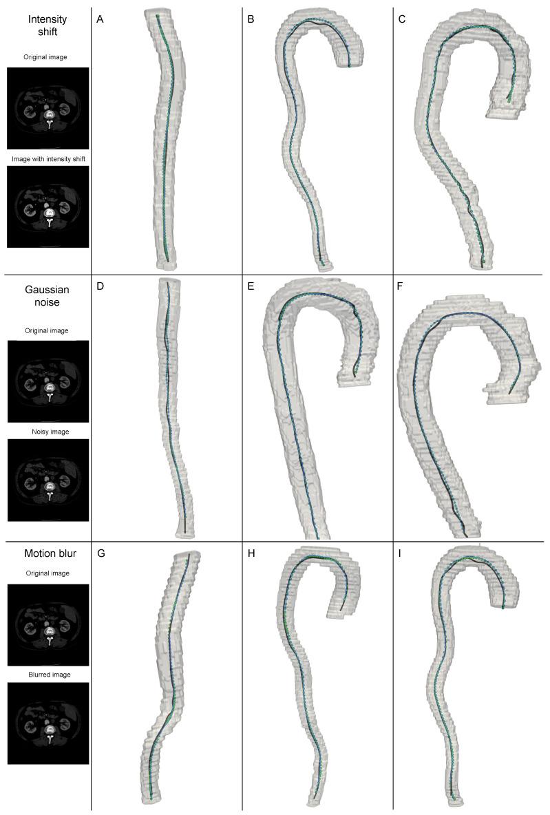 https://cdn.ncbi.nlm.nih.gov/pmc/blobs/c825/12295992/22471f116c3f/jimaging-11-00209-g004.jpg