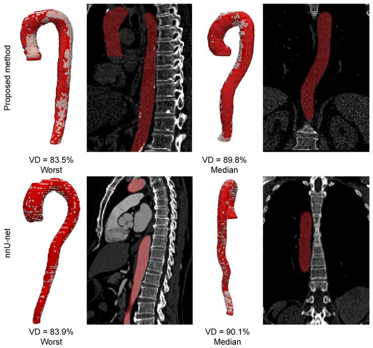 https://cdn.ncbi.nlm.nih.gov/pmc/blobs/c825/12295992/ab5f145ebdb1/jimaging-11-00209-g0A1.jpg