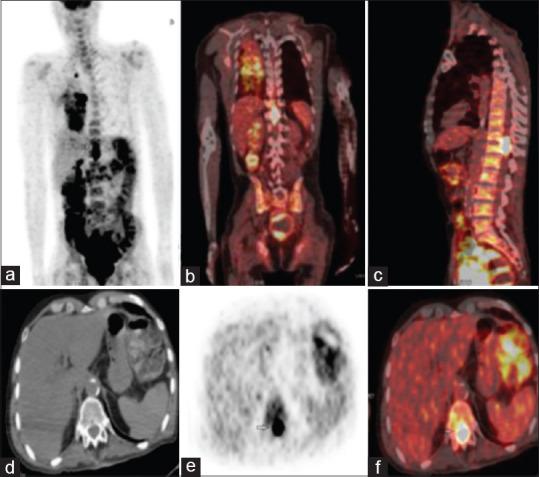 https://cdn.ncbi.nlm.nih.gov/pmc/blobs/c825/7905291/a64317554397/IJNM-35-353-g001.jpg