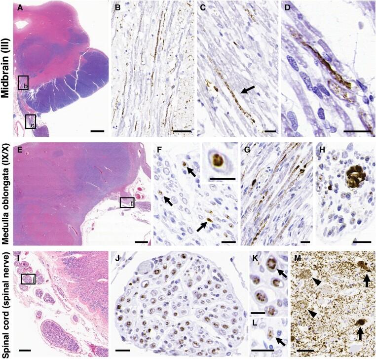 https://cdn.ncbi.nlm.nih.gov/pmc/blobs/c826/10994524/f2a4c5f972a3/awad381f1.jpg