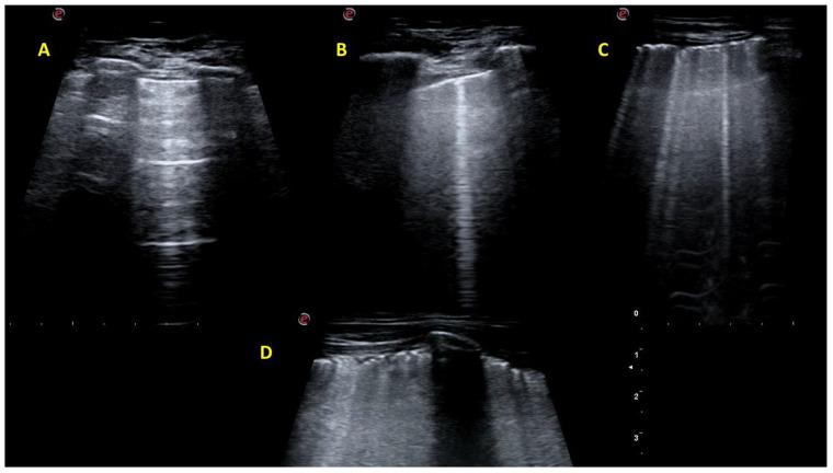 https://cdn.ncbi.nlm.nih.gov/pmc/blobs/c826/12156292/9023ac96152b/jcm-14-03701-g001.jpg
