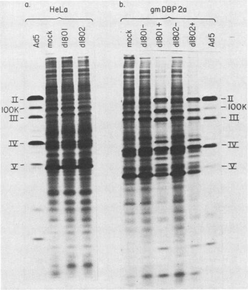 https://cdn.ncbi.nlm.nih.gov/pmc/blobs/c829/252647/649cbdc1dfd6/jvirol00117-0129-a.jpg