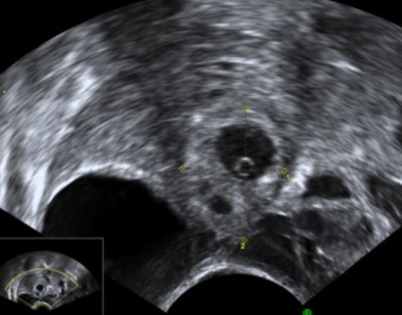 https://cdn.ncbi.nlm.nih.gov/pmc/blobs/c82a/4489732/53aded0495e0/pone.0130598.g001.jpg