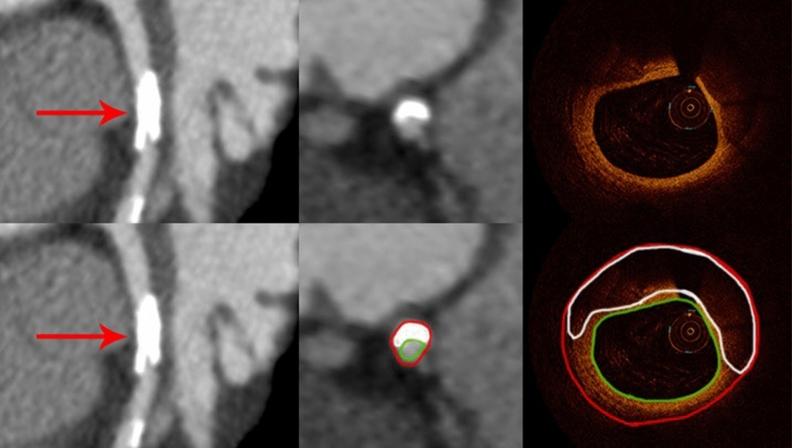 https://cdn.ncbi.nlm.nih.gov/pmc/blobs/c82c/10363114/8e691b7891e8/41598_2023_38675_Fig2_HTML.jpg