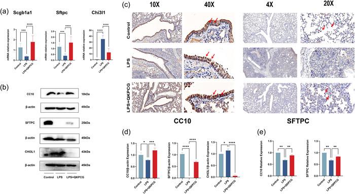https://cdn.ncbi.nlm.nih.gov/pmc/blobs/c82d/9500488/ead4313ac83f/PUL2-12-e12138-g004.jpg