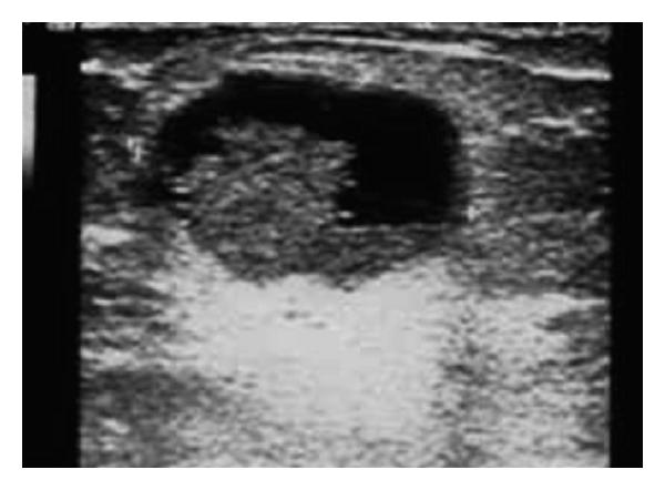 https://cdn.ncbi.nlm.nih.gov/pmc/blobs/c82e/3335648/a684f2213cb2/CRIM.OBGYN2012-979563.003.jpg