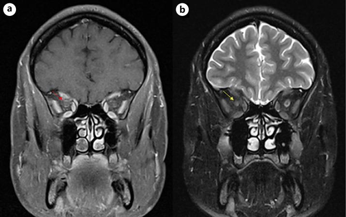 https://cdn.ncbi.nlm.nih.gov/pmc/blobs/c835/9251448/5f70716e6aca/cop-0013-0470-g02.jpg