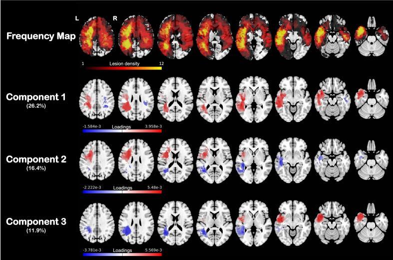 https://cdn.ncbi.nlm.nih.gov/pmc/blobs/c841/9668620/04ecd125e25b/gr2.jpg