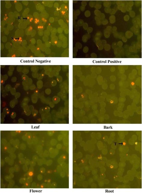 https://cdn.ncbi.nlm.nih.gov/pmc/blobs/c843/5594526/14bdc43715ea/12906_2017_1958_Fig2_HTML.jpg