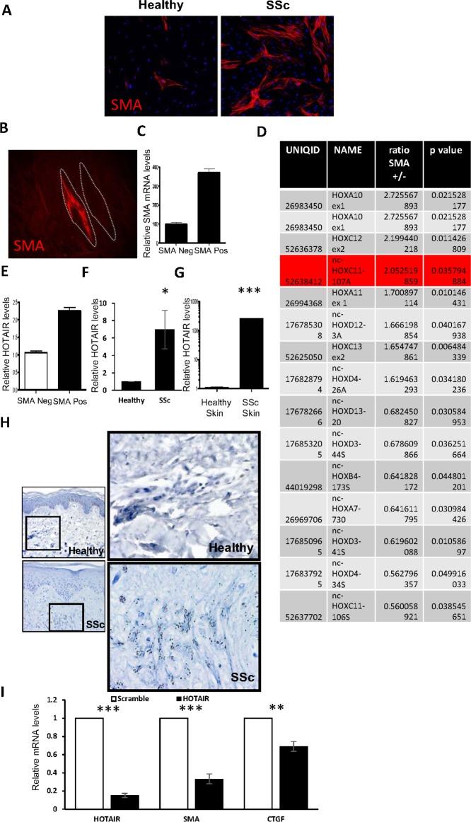 https://cdn.ncbi.nlm.nih.gov/pmc/blobs/c844/7147169/d6566003ecdf/annrheumdis-2019-216542f01.jpg