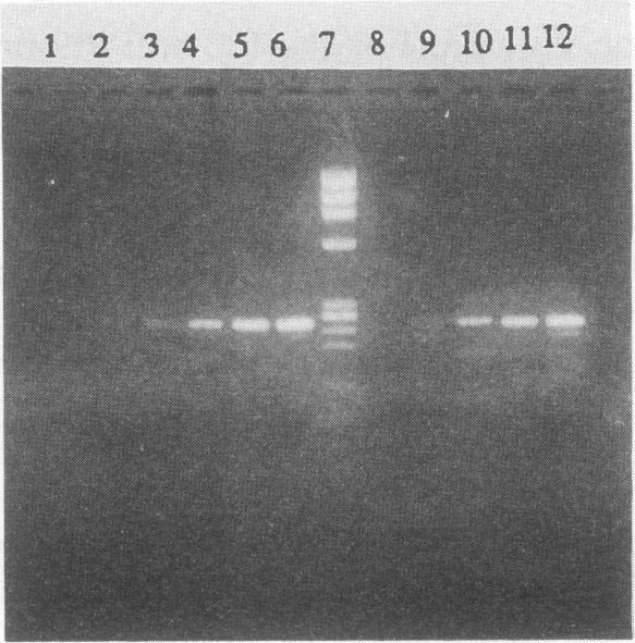 https://cdn.ncbi.nlm.nih.gov/pmc/blobs/c846/270480/a8b5f8ada1ea/jcm00034-0064-a.jpg