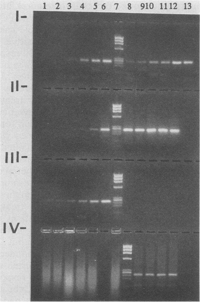https://cdn.ncbi.nlm.nih.gov/pmc/blobs/c846/270480/e293c5963026/jcm00034-0065-b.jpg
