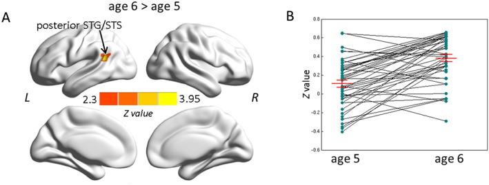 https://cdn.ncbi.nlm.nih.gov/pmc/blobs/c847/4767215/75115389142f/gr3.jpg