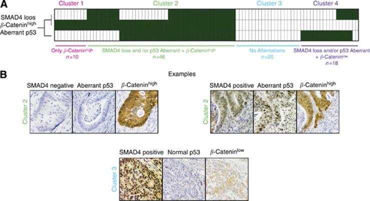 https://cdn.ncbi.nlm.nih.gov/pmc/blobs/c853/4453609/236a56125631/bjc2014560f1.jpg