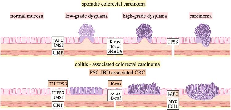 https://cdn.ncbi.nlm.nih.gov/pmc/blobs/c86c/12018527/63c087d70d54/428_2025_4072_Fig1_HTML.jpg