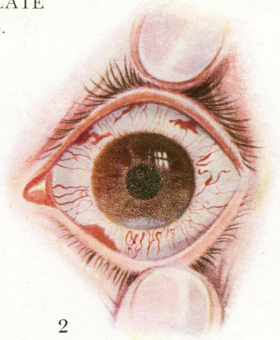 https://cdn.ncbi.nlm.nih.gov/pmc/blobs/c876/1998390/0d6a32b3ff01/procrsmed00635-0093-b.jpg
