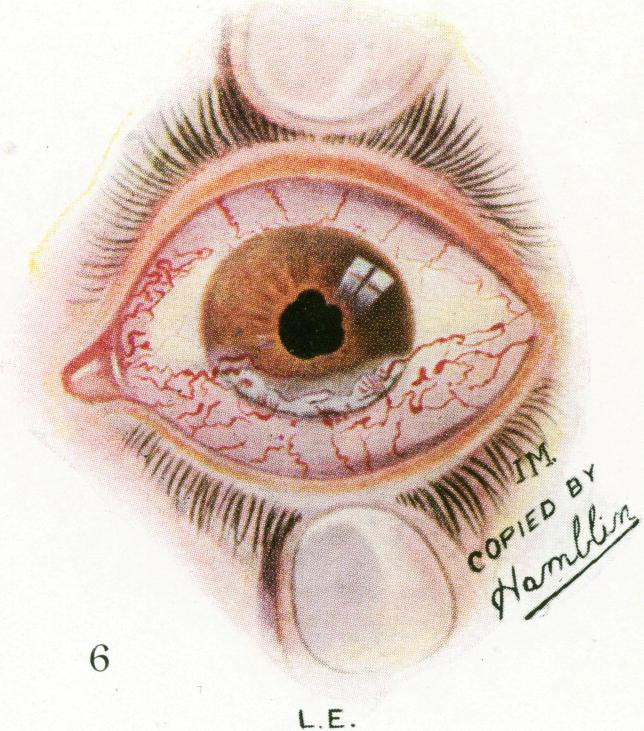 https://cdn.ncbi.nlm.nih.gov/pmc/blobs/c876/1998390/fd8ff67cd52c/procrsmed00635-0093-f.jpg