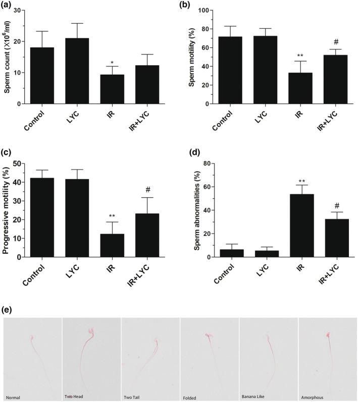https://cdn.ncbi.nlm.nih.gov/pmc/blobs/c877/10804090/61c948a3a702/FSN3-12-534-g007.jpg