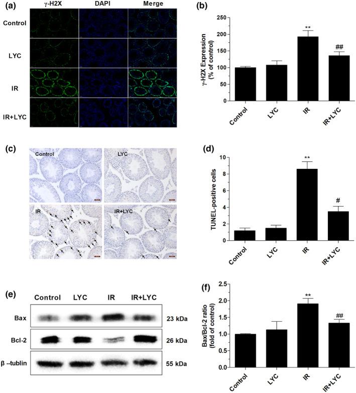 https://cdn.ncbi.nlm.nih.gov/pmc/blobs/c877/10804090/8a72dc5eb549/FSN3-12-534-g003.jpg