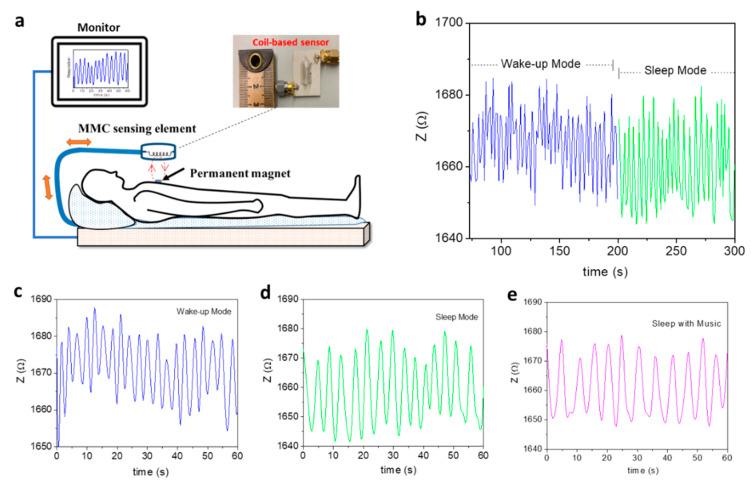 https://cdn.ncbi.nlm.nih.gov/pmc/blobs/c879/9313129/12c39b737074/biosensors-12-00517-g011.jpg