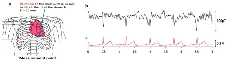https://cdn.ncbi.nlm.nih.gov/pmc/blobs/c879/9313129/5a37b2237871/biosensors-12-00517-g009.jpg
