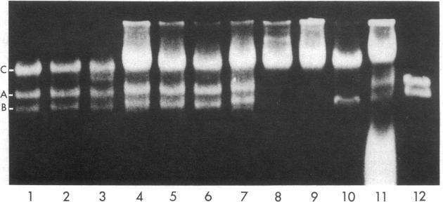 https://cdn.ncbi.nlm.nih.gov/pmc/blobs/c87d/319159/1765ca4e554f/pnas00654-0218-a.jpg