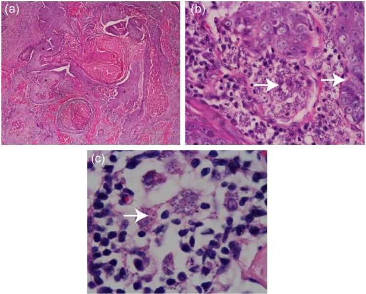 https://cdn.ncbi.nlm.nih.gov/pmc/blobs/c87f/5362010/c50423d5364c/10.1177_2055116915593969-fig2.jpg