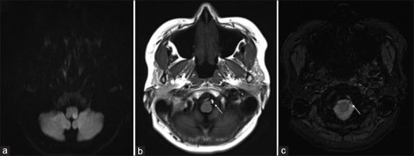 https://cdn.ncbi.nlm.nih.gov/pmc/blobs/c882/10167846/b665dcf53c69/BC-8-222-g001.jpg