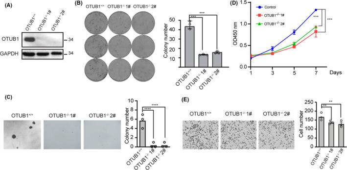 https://cdn.ncbi.nlm.nih.gov/pmc/blobs/c882/8177800/6c6f3c39882e/CAS-112-2199-g003.jpg