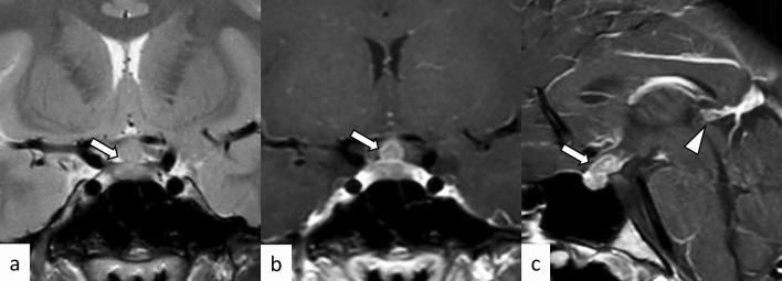 https://cdn.ncbi.nlm.nih.gov/pmc/blobs/c887/10468747/2276eec969bb/11604_2023_1417_Fig15_HTML.jpg