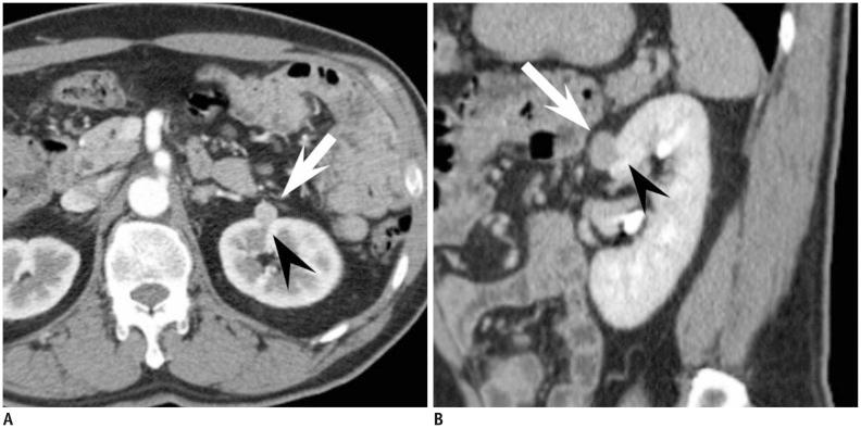 https://cdn.ncbi.nlm.nih.gov/pmc/blobs/c892/4296282/76887177ba5c/kjr-16-99-g003.jpg