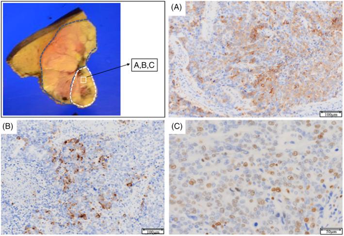 https://cdn.ncbi.nlm.nih.gov/pmc/blobs/c893/9875614/4ca004af83e7/CNR2-6-e1772-g003.jpg