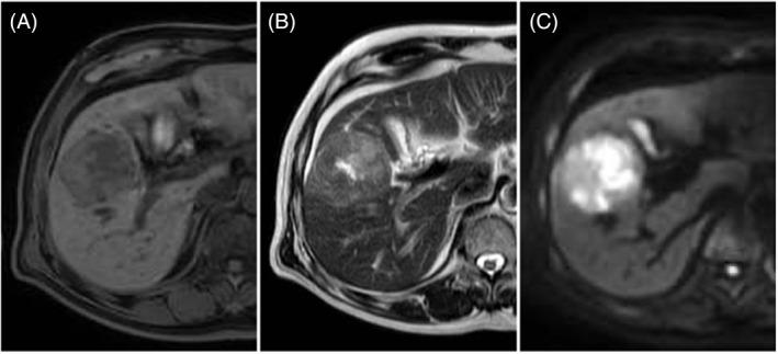 https://cdn.ncbi.nlm.nih.gov/pmc/blobs/c893/9875614/8960da176a60/CNR2-6-e1772-g005.jpg