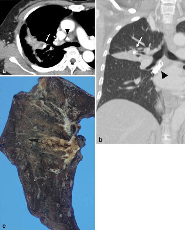 https://cdn.ncbi.nlm.nih.gov/pmc/blobs/c898/3609961/197a21589c80/13244_2012_205_Fig8_HTML.jpg