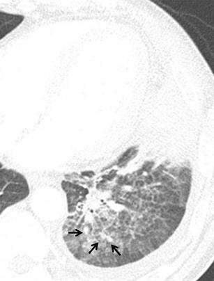 https://cdn.ncbi.nlm.nih.gov/pmc/blobs/c898/3609961/1a79845e5f96/13244_2012_205_Fig2_HTML.jpg