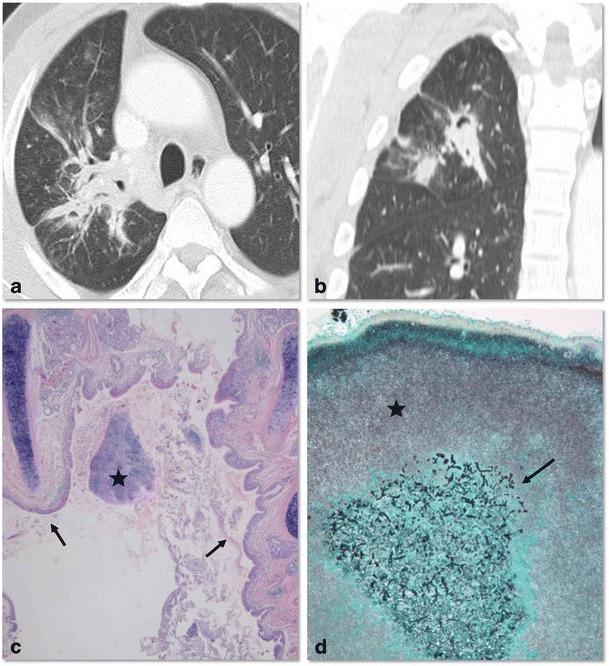 https://cdn.ncbi.nlm.nih.gov/pmc/blobs/c898/3609961/82930791bfe5/13244_2012_205_Fig6_HTML.jpg