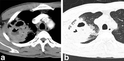 https://cdn.ncbi.nlm.nih.gov/pmc/blobs/c898/3609961/92828ac55d47/13244_2012_205_Fig3_HTML.jpg