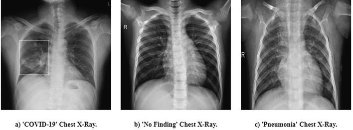https://cdn.ncbi.nlm.nih.gov/pmc/blobs/c8a2/7513693/baf05ae2db21/gr8_lrg.jpg