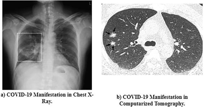 https://cdn.ncbi.nlm.nih.gov/pmc/blobs/c8a2/7513693/c613571005eb/gr1_lrg.jpg