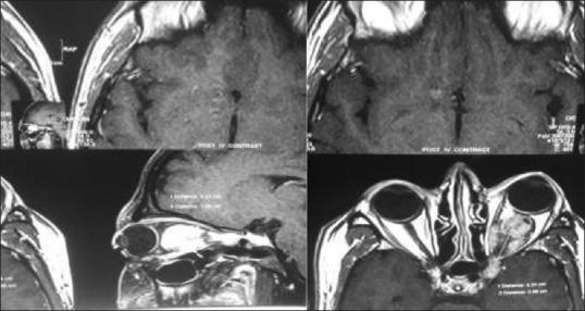 https://cdn.ncbi.nlm.nih.gov/pmc/blobs/c8a8/4329715/fac403eca57c/JOVR-9-514-g002.jpg