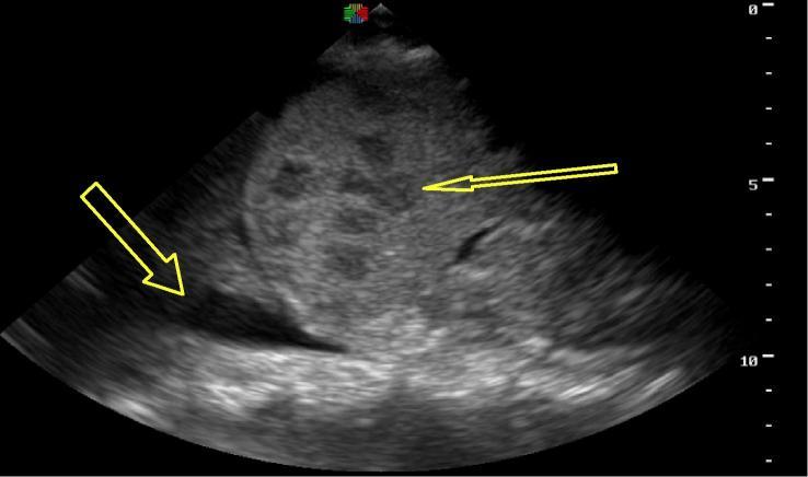 https://cdn.ncbi.nlm.nih.gov/pmc/blobs/c8ac/6234193/175901d7dd63/gr1.jpg
