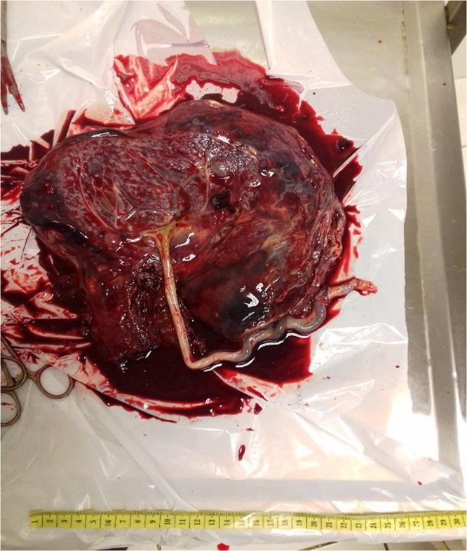 https://cdn.ncbi.nlm.nih.gov/pmc/blobs/c8b0/12282531/80c2ce9c3421/IMCRJ-18-893-g0004.jpg