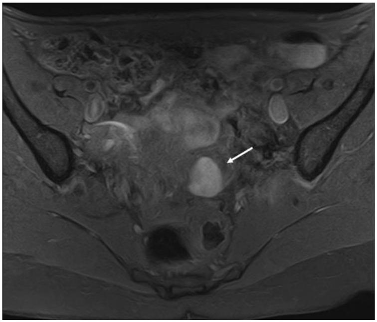 https://cdn.ncbi.nlm.nih.gov/pmc/blobs/c8b8/9777476/7183053b4812/diagnostics-12-02960-g006.jpg